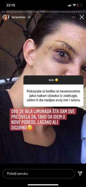 UZNEMIRUJUĆI SADRŽAJ Tara Simov objavila fotografiju na kojoj je sva u modricama i šavovima, posle jezive tuče svima poručila samo jedno (FOTO)