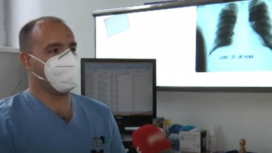 PRVO SE ŽALIO NA KAŠALJ, PA POKAZAO SNIMAK PLUĆA Doktorka iz Srbije ostala bez teksta kad je videla šta se nalazi kod srca (VIDEO)