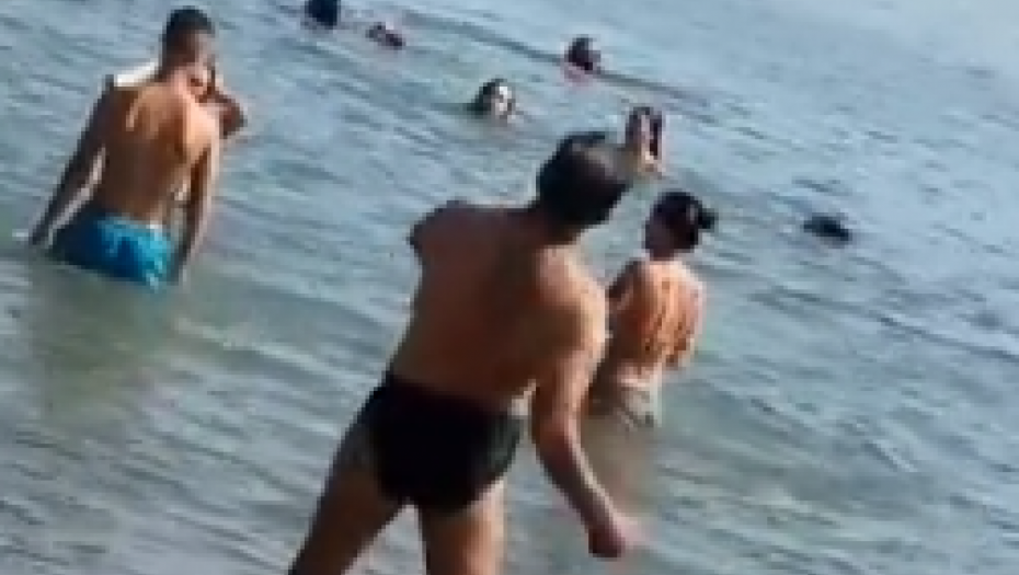 DEVOJČICA VRIŠTALA OD BOLOVA NA PLAŽI U GRČKOJ, IMA TEŠKE OPEKOTINE: Lečenje traje 6 meseci - budite oprezni!