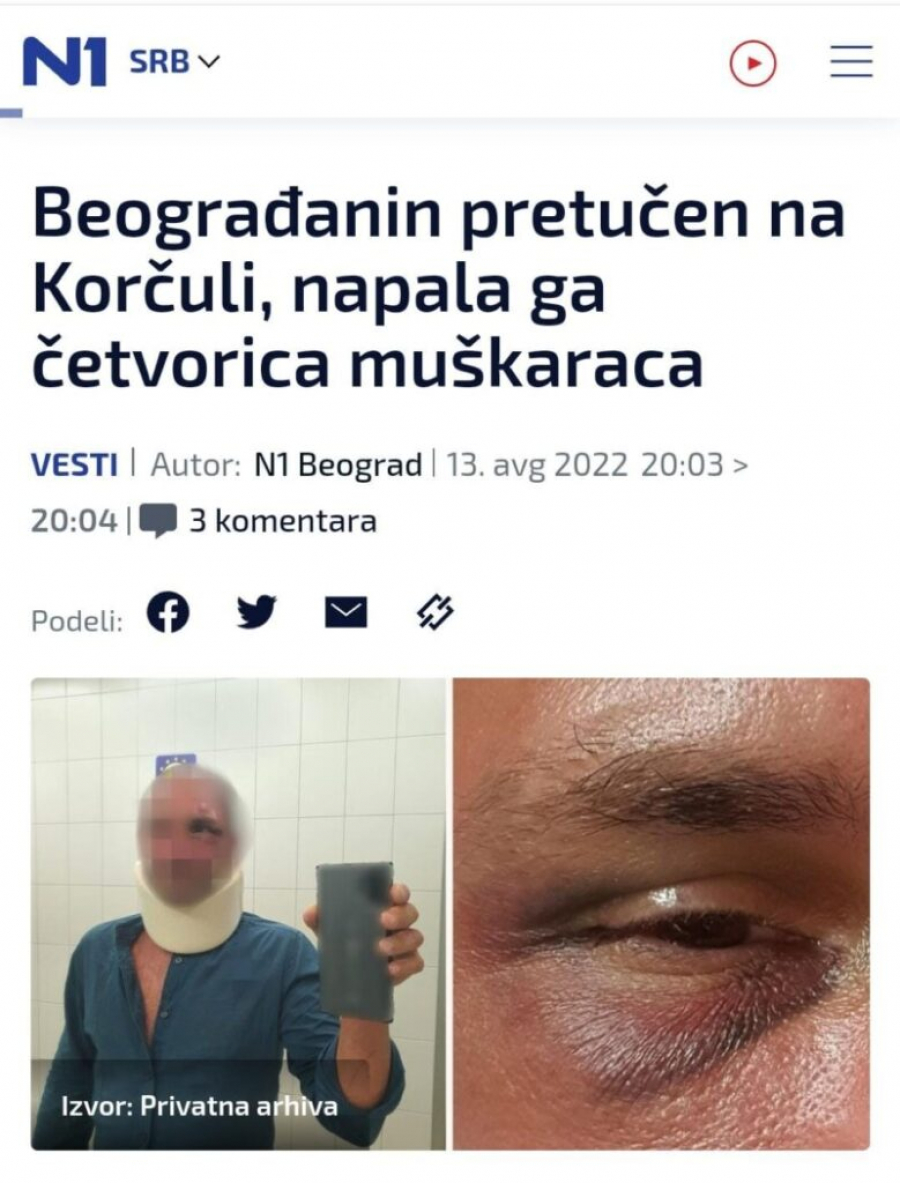 SRBIN BRUTALNO PRETUČEN U HRVATSKOJ Policija nezainteresovana, a u bolnici mu rekli: Nije ti ništa!