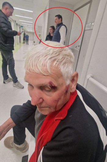 JE L' VAM SMEŠNO NASILJE? Čoveka upropastili, razbili mu glavu, a blokaderi pucaju od smeha! Bolesno!