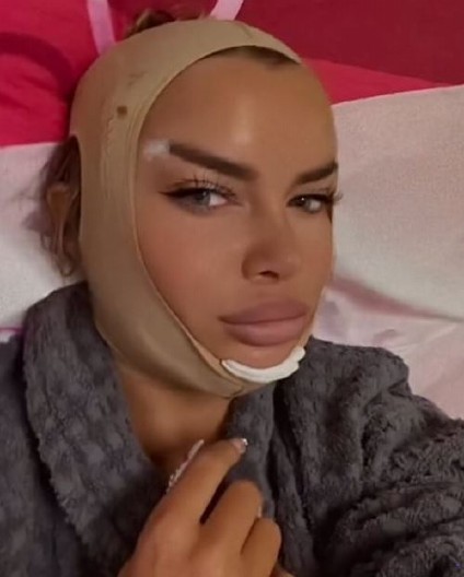 ''ZAVISNIK SAM ESTETSKIH OPERACIJA'' Bivša zadrugarka bez dlake na jeziku priznala na kakvu promenu se sada odlučila (FOTO)