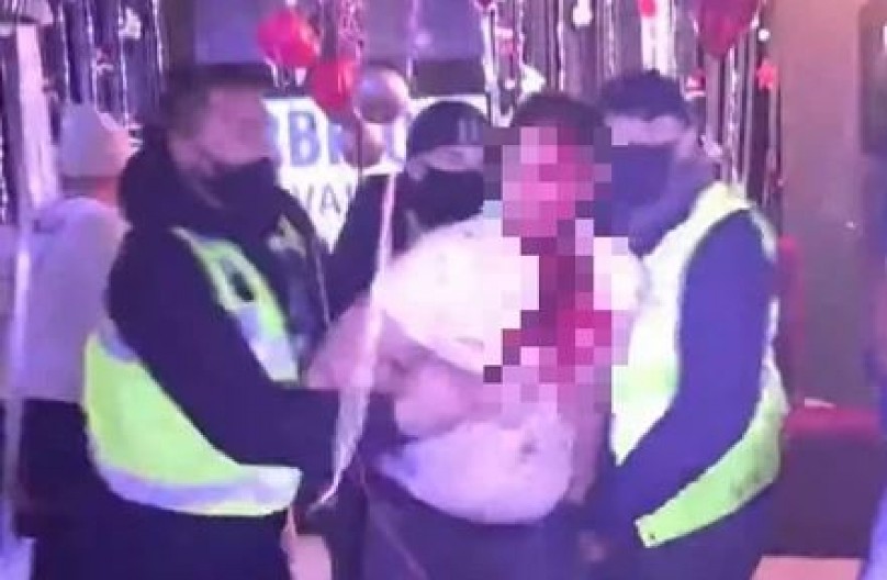 UDARA GLAVOM O ZID, KRV LIJE NA SVE STRANE! Ovo je najmonstruoznija scena u rijalitiju ikada, od ovih kadrova podilazi jeza!