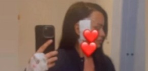 "ŽIVA SAM..." Bivšoj zadrugarki uklonjen tumor iz glave, evo u kakvom je stanju nakon teške operacije (FOTO)