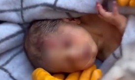 POZNATA SUDBINA BEBE IZ MALOŠIŠTA KOJU JE MAJKA OSTAVILA U KONTEJNERU! Majka upućena na veštanje u Gornju Toponicu!