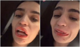 NAŠU INFLUENSERKU PRETUKAO DEČKO! Sva krvava i uplakana, jeca na sav glas: Zapamtićeš me za ovo! (FOTO)