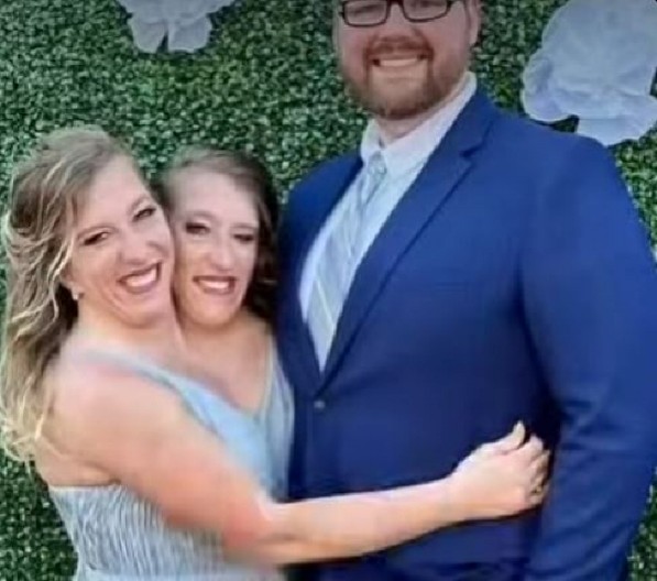 POSTALE MAJKE Najpoznatije sijamske bliznakinje dočekale bebu, sestre primorane na ZAJEDNIČKOG MUŽA