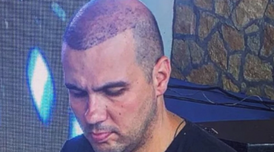 "JEO SAM OSTATKE TUĐIH SENDVIČA" Pevač otkrio kroz šta je prošao: "Od stresa mi je opala kosa"