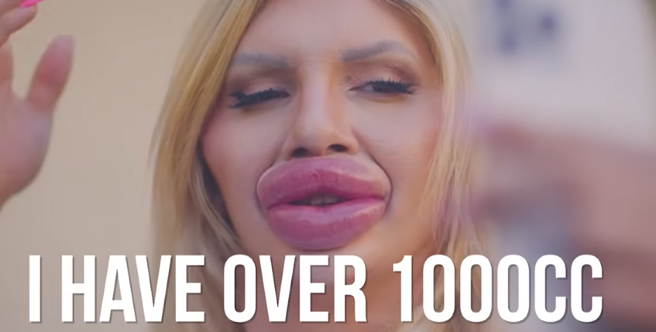 ZOVU JE FRANKENŠTAJN I KAŽU DA JE MAJKA MONSTRUM Evo kako izgleda devojka koja je uložila 42.000 evra da bi imala najveća usta na svetu (FOTO/VIDEO)