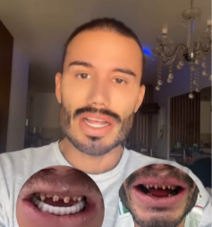 ESTRADNI FRIZER BIO NA SUDU SA DOKTORKOM Navodi se da je umro od sepse: "Masakrirala si me zdravstveno!"